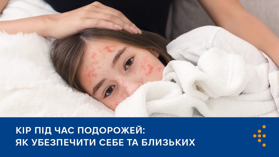Кір під час подорожей: як убезпечити себе та близьких Кір під час подорожей: як убезпечити себе та близьких