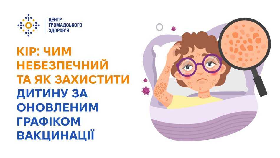 Кір: чим небезпечний та як захистити дитину за оновленим графіком вакцинації Кір: чим небезпечний та як захистити дитину за оновленим графіком вакцинації