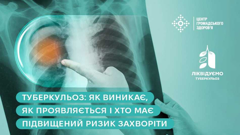 Туберкульоз: як виникає, як проявляється і хто має підвищений ризик захворіти Туберкульоз: як виникає, як проявляється і хто має підвищений ризик захворіти